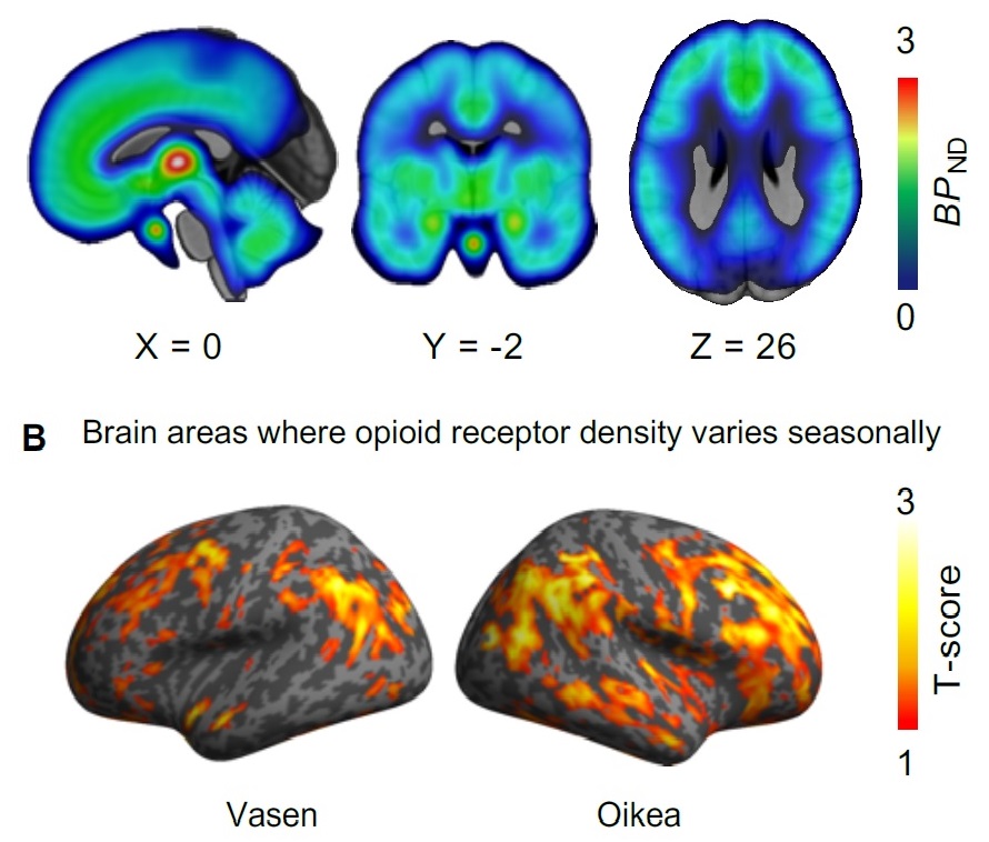 Five brains scans which show the brain areas where the opioid receptor density varies seasonally.