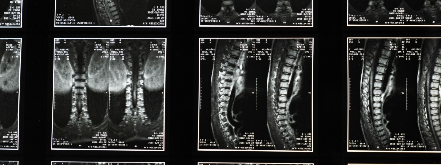 Röntgenkuvia selkärangasta