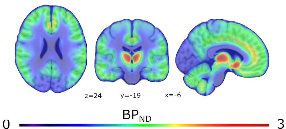 Graafinen kuva, jossa on kolmet aivot eri suunnista kuvattuna ja eri värisinä eri alueilta.