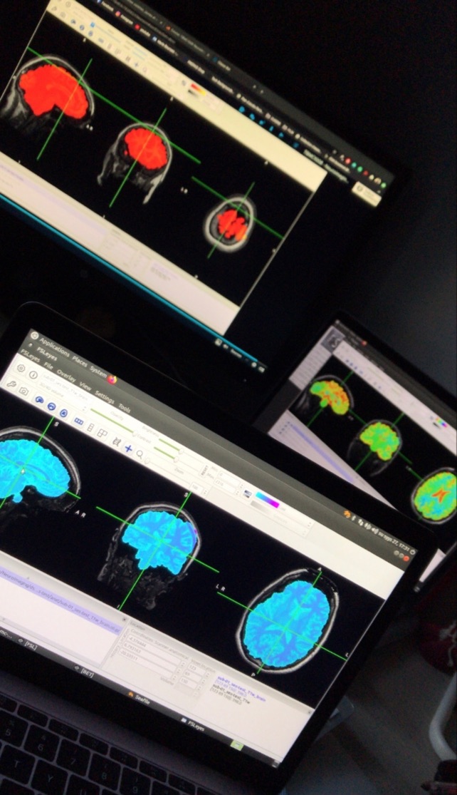 Image of MRI scans neuroimaging courses