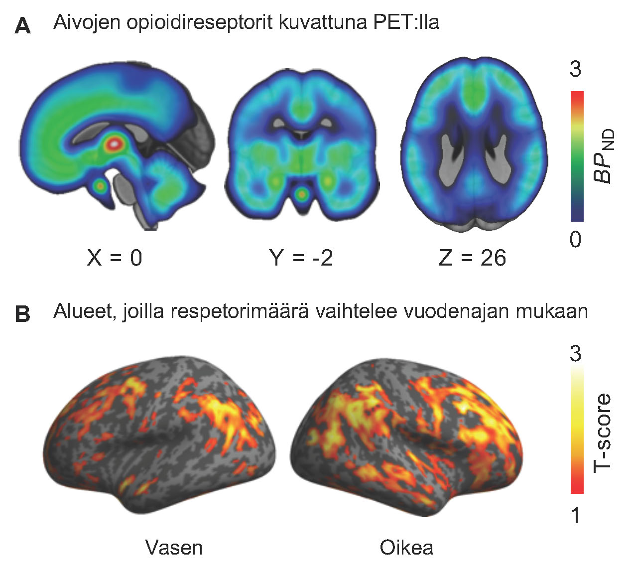PET-kuva, joka näyttää aivojen aktiiviset alueet tiivistyvän jännityksen aikana (ylempi rivi) ja yllättävän säikähdyksen aikana (alempi rivi).