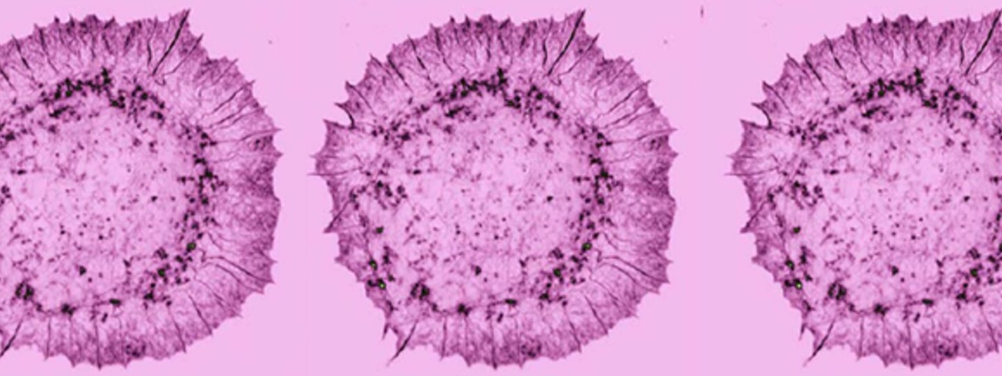vaaleanpunainen mikroskooppikuva