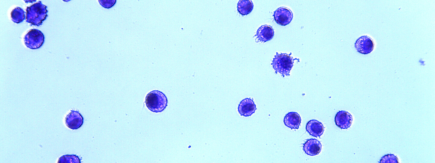 Makrofajea PAP-sairudessa