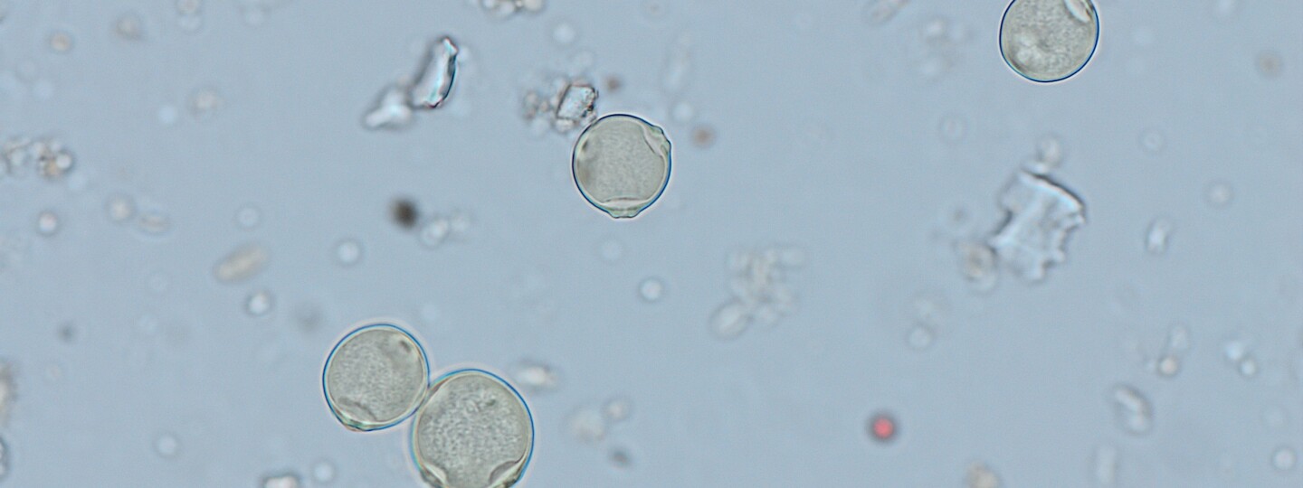 Koivun siitepölyhiukkasia mikroskoopin läpi nähtynä