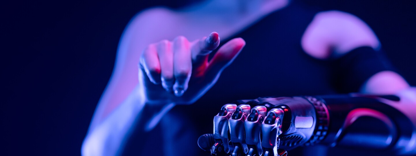 Woman with bionic arm