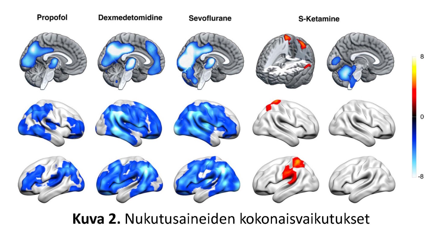 PET-kuvia aivoista, jaoteltuina eri nukutusaineiden alle