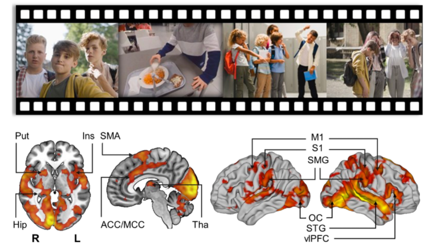 Kuvan yläosassa on neljä valokuvaa kiusaamistilanteista ja alaosassa neljä kuvaa aivoista, joiden eri osiot on merkattu oranssilla.