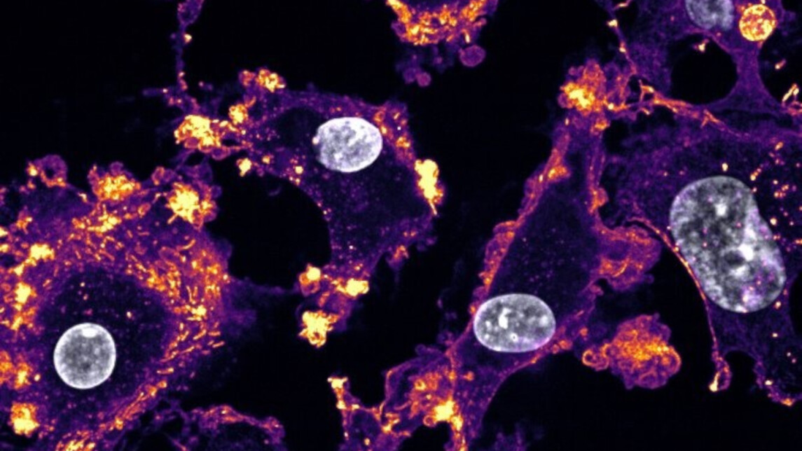 Mikroskooppikuva makrofageista