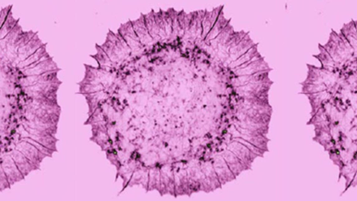 vaaleanpunainen mikroskooppikuva