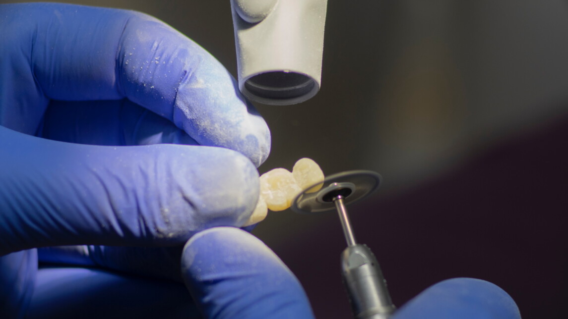 Hammaslääkäri hioo hammasimplantteja