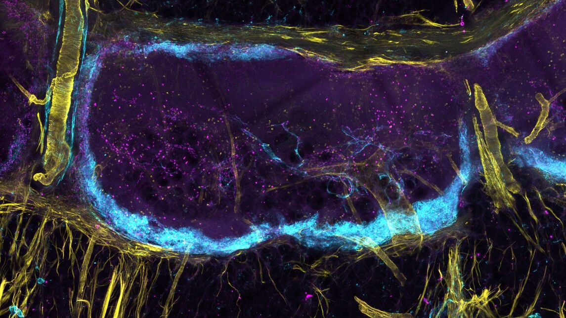 Microscope image on lymphatic vasculatures