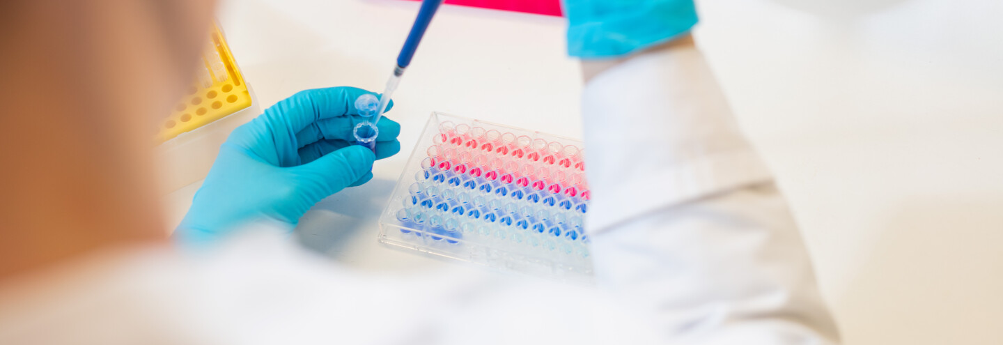 Henkilö työskentelee laboratoriossa pipetin kanssa.