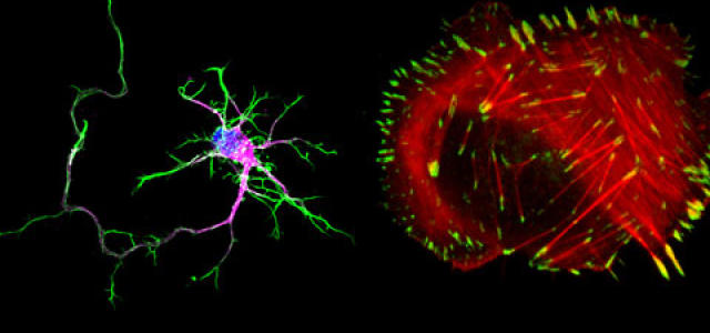 Neuron-vs-cancer-cell-480.jpg