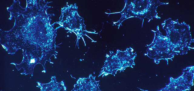 cancer-cells-541954_640.jpg