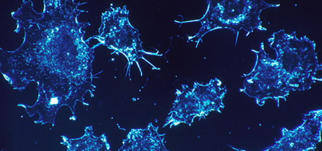 cancer-cells-541954_960_720.jpg