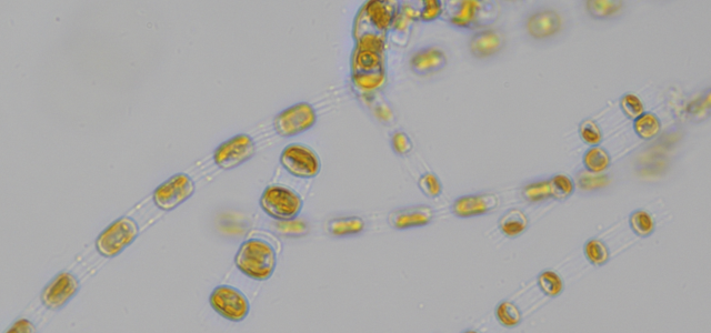Mikroskooppikuva piilevästä: keltaisia palluroita valkoisella taustalla.