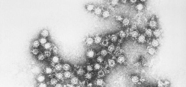 Coxsackie B4 -virus 
