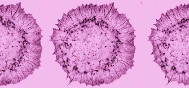 vaaleanpunainen mikroskooppikuva