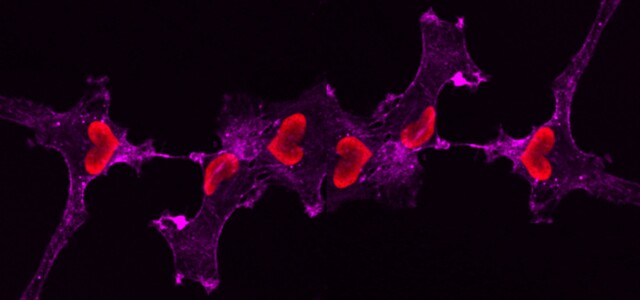 Microscopy image, black background, lilac shapes, pink heart-shaped cells