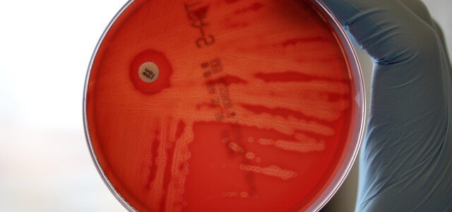 bakteerimalja, joss a streprokokkia