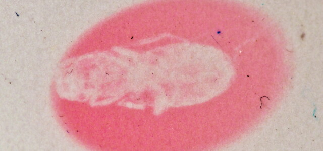 Hackmaniittikalvolle jää läpivalaistu kuva muurahaisesta röntgenaltistuksen jälkeen. Kuva on otettu järjestelmäkameralla. Kuva: Sami Vuori. 