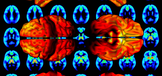 kuvituskuva aivojen opioidijärjestelmästä