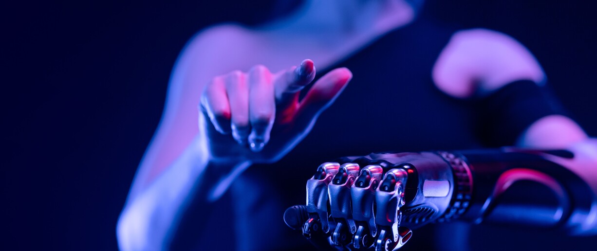 Woman with bionic arm
