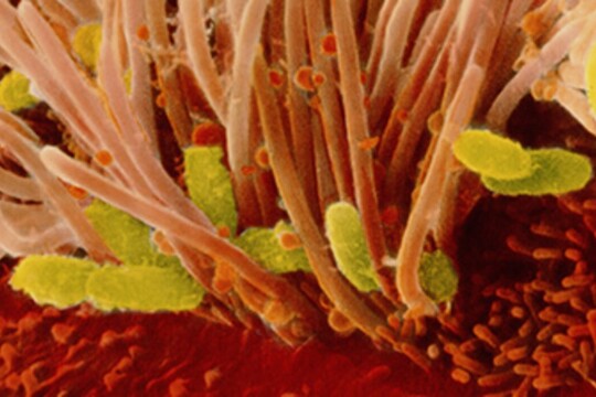 kuva hinkuyskäbakteereista