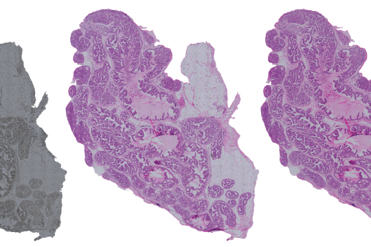Kuvassa värjäämätön, perinteisellä menetelmällä ja virtuaalisella menetelmällä värjätty kudosnäyte. Perinteinen ja virtuaalinen näyttävät samalta.