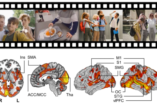 Kuvan yläosassa on neljä valokuvaa kiusaamistilanteista ja alaosassa neljä kuvaa aivoista, joiden eri osiot on merkattu oranssilla.
