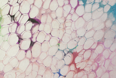 taiteellinen kuvaus rasvasolukosta