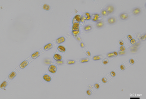 Mikroskooppikuva piilevästä: keltaisia palluroita valkoisella taustalla.