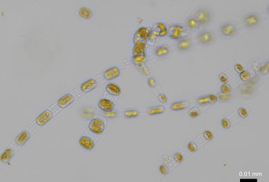 Mikroskooppikuva piilevästä: keltaisia palluroita valkoisella taustalla.