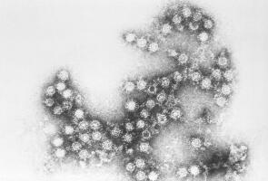 Coxsackie B4 -virus 