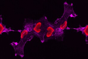 Microscopy image, black background, lilac shapes, pink heart-shaped cells