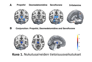 Kuvia aivoista kuvattuna PET-kameralla ja jaoteltuna eri nukutusaineisiin